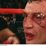 克里琴科 Klitschko