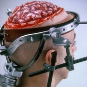 是谁让我脑死了 Brain Dead